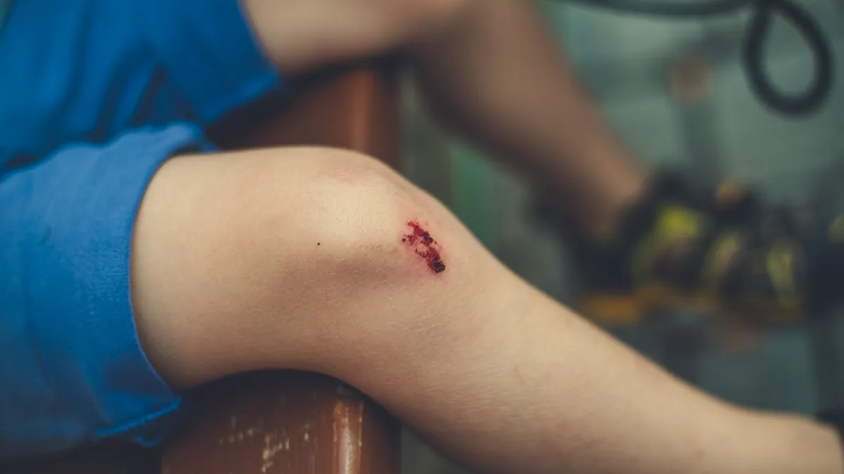 Unexplained Bite Marks and Welts Appearing on Your Skin During or After Your Stay